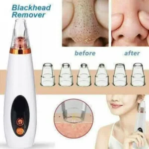 blackheads-remover-machine