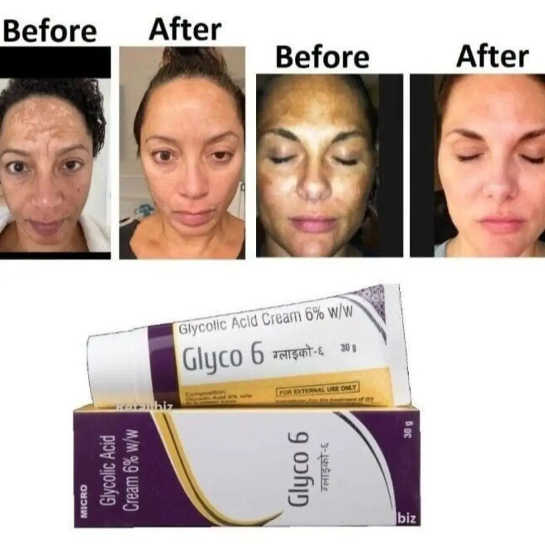 Glyco 6 Glycolic Acid Cream 6