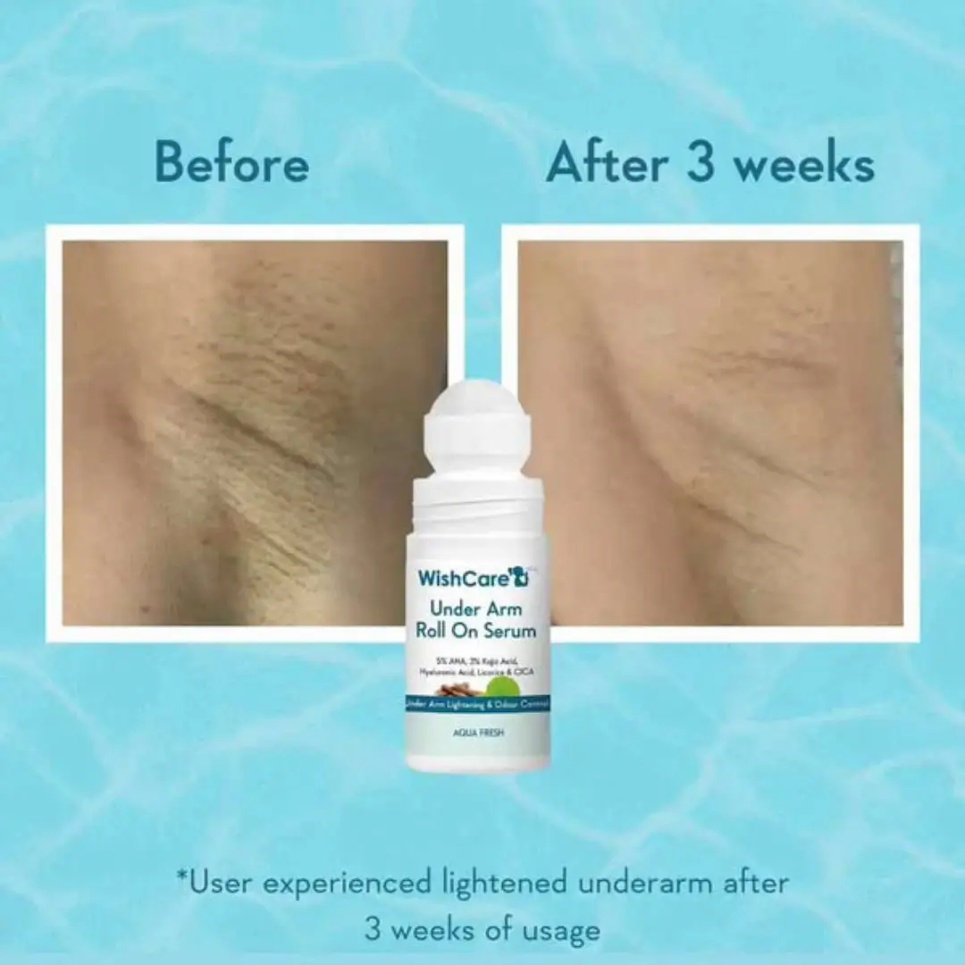WishCare Underarm Serum Roll On ball application top view