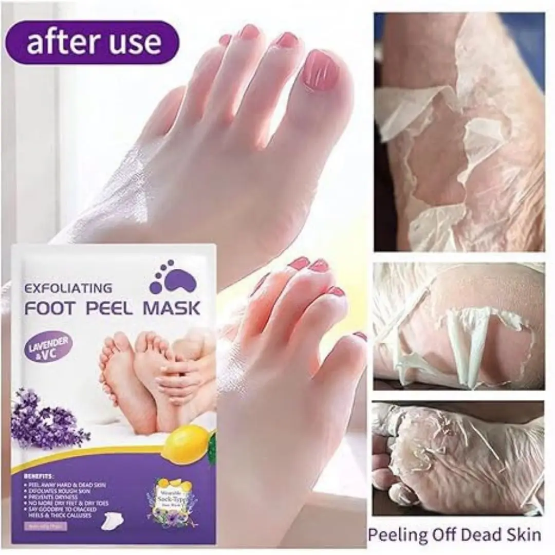APPTI foot peel mask after use peeling off dead skin results