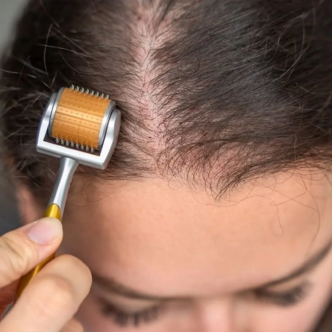 ZGTS Titanium Derma Roller being used on scalp for hair growth